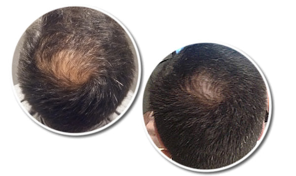 R12 Tri Peptide Active Hair Serum for Men 30 ml