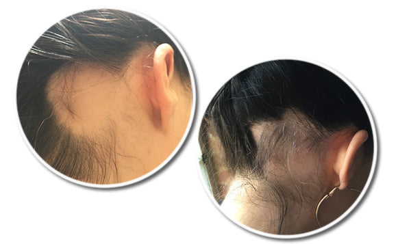 Reseed R12 Tri Peptide Hair Growth Serum for Women 30 ml